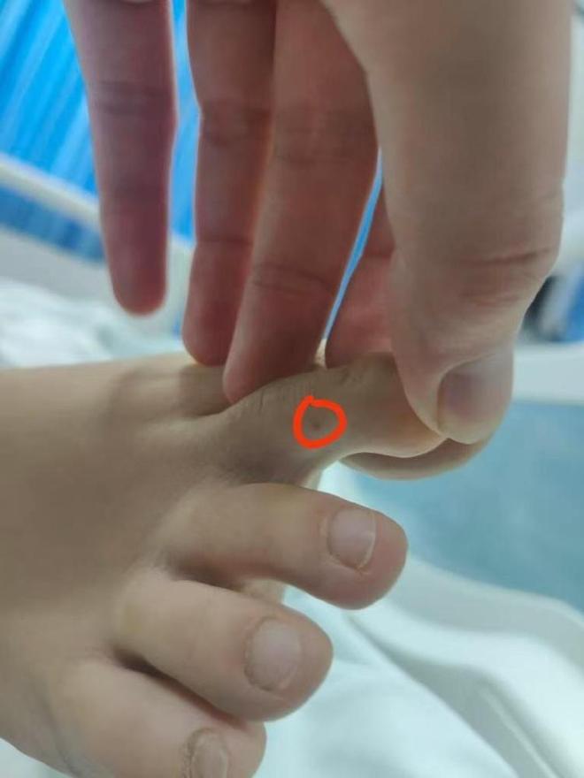 27岁女游客三亚被蛇咬身亡专家急吼：秒拍蛇照是救命关键