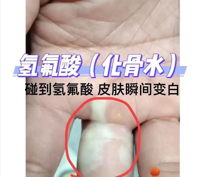 震惊！杭州女子散步踩到化骨水毒发身亡如此危险品竟可网购？(图6)